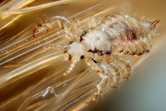 What do head lice & nits look like? | Lyclear