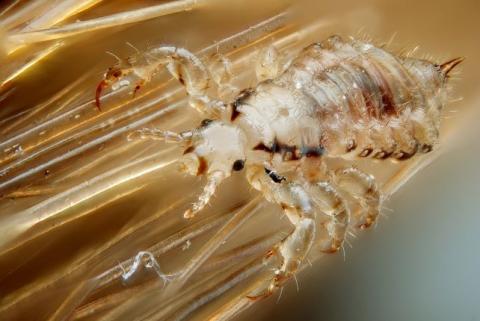 Male head lice on hair